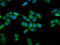 PR/SET Domain 11 antibody, LS-C681117, Lifespan Biosciences, Immunofluorescence image 