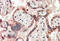 Teratocarcinoma-Derived Growth Factor 1 antibody, MBS421778, MyBioSource, Immunohistochemistry paraffin image 