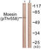 Ezrin antibody, LS-C199272, Lifespan Biosciences, Western Blot image 