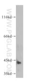 Arylsulfatase B antibody, 13227-1-AP, Proteintech Group, Western Blot image 