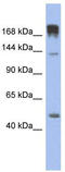 Slit Guidance Ligand 3 antibody, TA344211, Origene, Western Blot image 