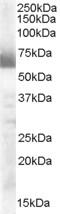 Signal Transducing Adaptor Molecule 2 antibody, 46-438, ProSci, Western Blot image 