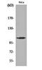 Mitogen-Activated Protein Kinase Kinase Kinase 13 antibody, orb161656, Biorbyt, Western Blot image 