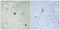 DNA Topoisomerase II Alpha antibody, LS-C199675, Lifespan Biosciences, Immunohistochemistry paraffin image 