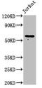 Interleukin 18 Receptor 1 antibody, LS-C671980, Lifespan Biosciences, Western Blot image 