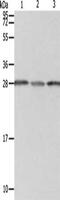 Proteasome 26S Subunit, Non-ATPase 9 antibody, CSB-PA576314, Cusabio, Western Blot image 