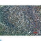 Interferon Regulatory Factor 3 antibody, LS-C813898, Lifespan Biosciences, Immunohistochemistry paraffin image 