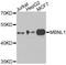 Muscleblind Like Splicing Regulator 1 antibody, A02309, Boster Biological Technology, Western Blot image 
