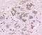 Cytochrome P450 Family 17 Subfamily A Member 1 antibody, NBP2-75461, Novus Biologicals, Immunohistochemistry paraffin image 