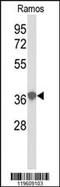 Eukaryotic Translation Elongation Factor 1 Delta antibody, MBS9202533, MyBioSource, Western Blot image 