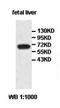 Crystallin Beta-Gamma Domain Containing 2 antibody, orb77535, Biorbyt, Western Blot image 