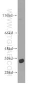 Spermidine Synthase antibody, 19858-1-AP, Proteintech Group, Western Blot image 