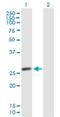 IPP isomerase 2 antibody, H00091734-B01P, Novus Biologicals, Western Blot image 