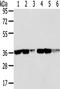Transaldolase 1 antibody, TA350531, Origene, Western Blot image 
