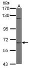 Zinc Finger Protein 334 antibody, NBP2-20995, Novus Biologicals, Western Blot image 