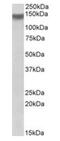 Integrin Subunit Alpha 11 antibody, orb22549, Biorbyt, Western Blot image 