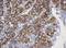 Galactosidase Beta 1 antibody, LS-C174334, Lifespan Biosciences, Immunohistochemistry paraffin image 