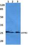 Glutathione S-Transferase Mu 2 antibody, PA5-75677, Invitrogen Antibodies, Western Blot image 