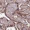 Ring Finger Protein 144A antibody, NBP2-13238, Novus Biologicals, Immunohistochemistry frozen image 