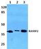 Ras association domain-containing protein 2 antibody, A04384, Boster Biological Technology, Western Blot image 