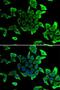 Sarcoglycan Delta antibody, LS-C748404, Lifespan Biosciences, Immunofluorescence image 