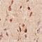 Neurofibromin 1 antibody, GTX30208, GeneTex, Immunohistochemistry paraffin image 