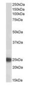 Chromobox 5 antibody, orb334078, Biorbyt, Western Blot image 
