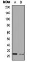 Sterile Alpha Motif Domain Containing 12 antibody, orb234147, Biorbyt, Western Blot image 