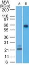 Mitochondrial Antiviral Signaling Protein antibody, TA336938, Origene, Western Blot image 