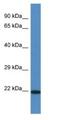 Transmembrane Protein 147 antibody, NBP1-79334, Novus Biologicals, Western Blot image 