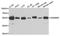 SAMM50 Sorting And Assembly Machinery Component antibody, A3401, ABclonal Technology, Western Blot image 
