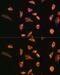 Small Proline Rich Protein 3 antibody, GTX65568, GeneTex, Immunofluorescence image 