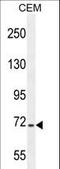 Stromal Interaction Molecule 1 antibody, LS-C161558, Lifespan Biosciences, Western Blot image 