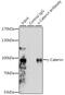 Junction Plakoglobin antibody, GTX32619, GeneTex, Immunoprecipitation image 