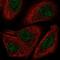 TOX High Mobility Group Box Family Member 2 antibody, NBP2-58503, Novus Biologicals, Immunocytochemistry image 