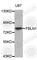 Fibulin 1 antibody, A3294, ABclonal Technology, Western Blot image 