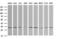 Retinoic Acid Receptor Responder 1 antibody, M10039-1, Boster Biological Technology, Western Blot image 