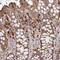 NAD Synthetase 1 antibody, HPA038524, Atlas Antibodies, Immunohistochemistry frozen image 