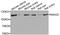 N-alpha-acetyltransferase 25, NatB auxiliary subunit antibody, A09617, Boster Biological Technology, Western Blot image 