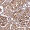 Coatomer Protein Complex Subunit Gamma 1 antibody, NBP1-85514, Novus Biologicals, Immunohistochemistry frozen image 