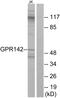 G Protein-Coupled Receptor 142 antibody, A30808, Boster Biological Technology, Western Blot image 