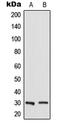 RAB23, Member RAS Oncogene Family antibody, LS-C353455, Lifespan Biosciences, Western Blot image 