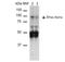 Sodium Channel Epithelial 1 Beta Subunit antibody, NBP2-59383, Novus Biologicals, Western Blot image 