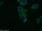 Vacuolar protein sorting-associated protein 13B antibody, 24505-1-AP, Proteintech Group, Immunofluorescence image 