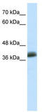 SAP30 Binding Protein antibody, TA335644, Origene, Western Blot image 