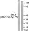 Mitogen-Activated Protein Kinase 15 antibody, PA5-38486, Invitrogen Antibodies, Western Blot image 