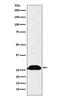 Immunoglobulin Kappa Constant antibody, M05470-5, Boster Biological Technology, Western Blot image 