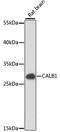 Calbindin 1 antibody, A15035, ABclonal Technology, Western Blot image 