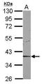 Cyclin Dependent Kinase 9 antibody, GTX107758, GeneTex, Western Blot image 