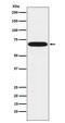 Cytochrome P450 Family 1 Subfamily B Member 1 antibody, M00515, Boster Biological Technology, Western Blot image 